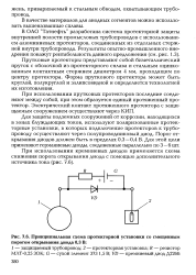 Принципиальная схема протекторной защиты